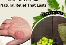 Effective Ayurvedic Cure for Eczema
