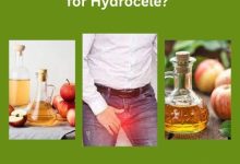 Does Apple Cider Vinegar Work for Hydrocele