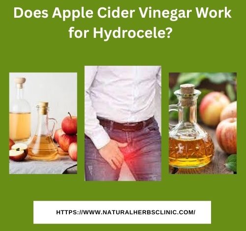 Does Apple Cider Vinegar Work for Hydrocele
