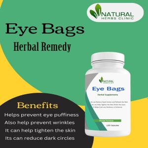 Herbal Remedies for Eye Bags
