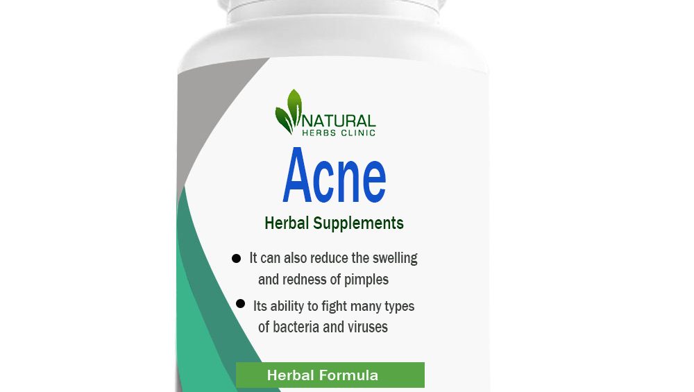 Herbal Supplements for Acne