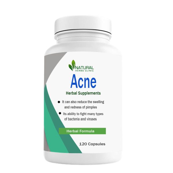 Herbal Supplements for Acne