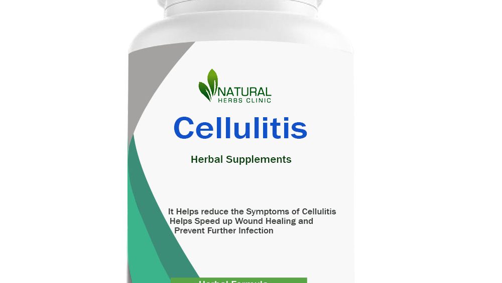 Herbal Supplements for Cellulitis