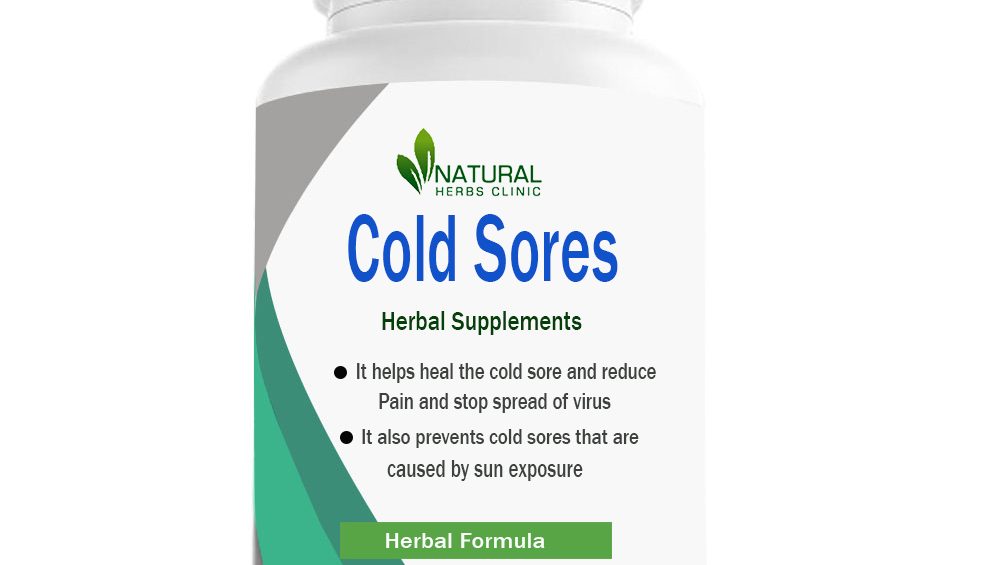 Herbal Supplements for Cold Sores
