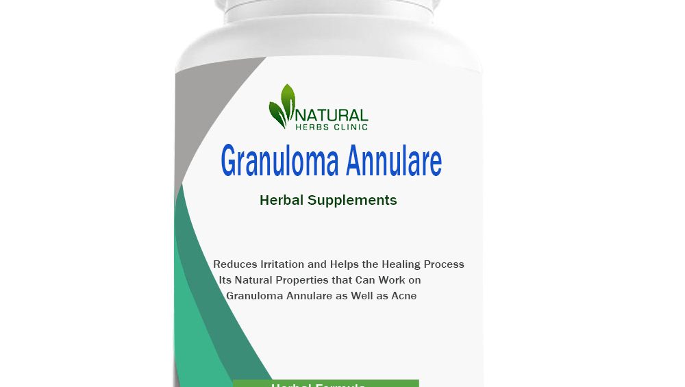 Herbal Supplements for Granuloma Annulare