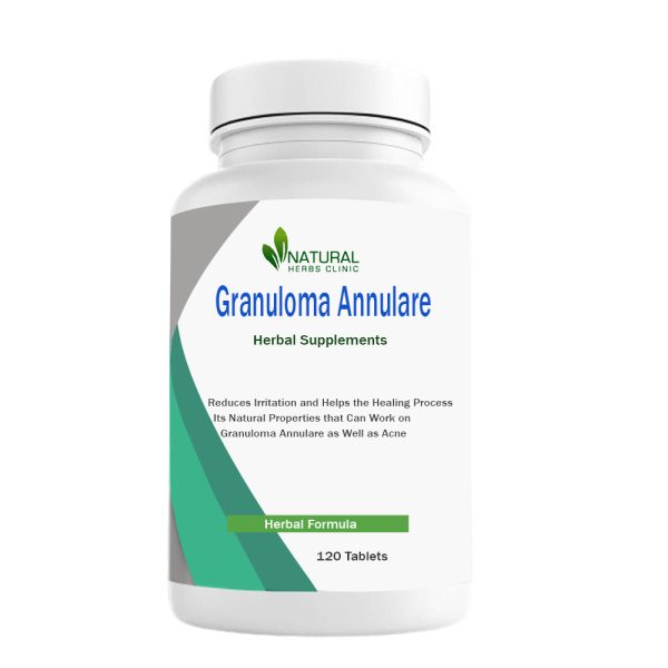 Herbal Supplements for Granuloma Annulare