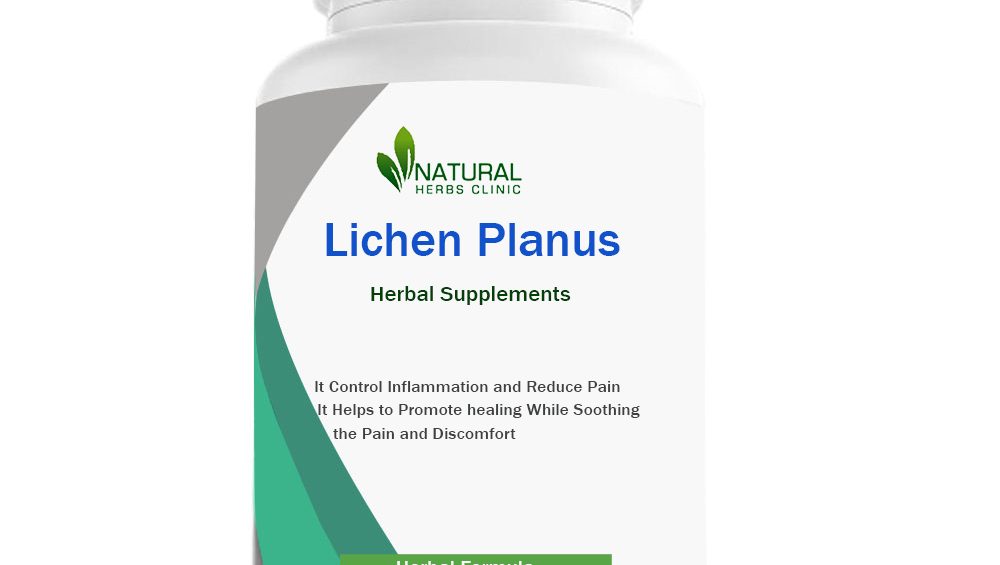 Herbal Supplements for Lichen Planus