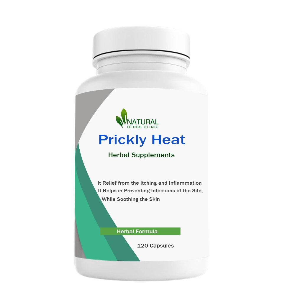 Herbal Supplements for Prickly Heat