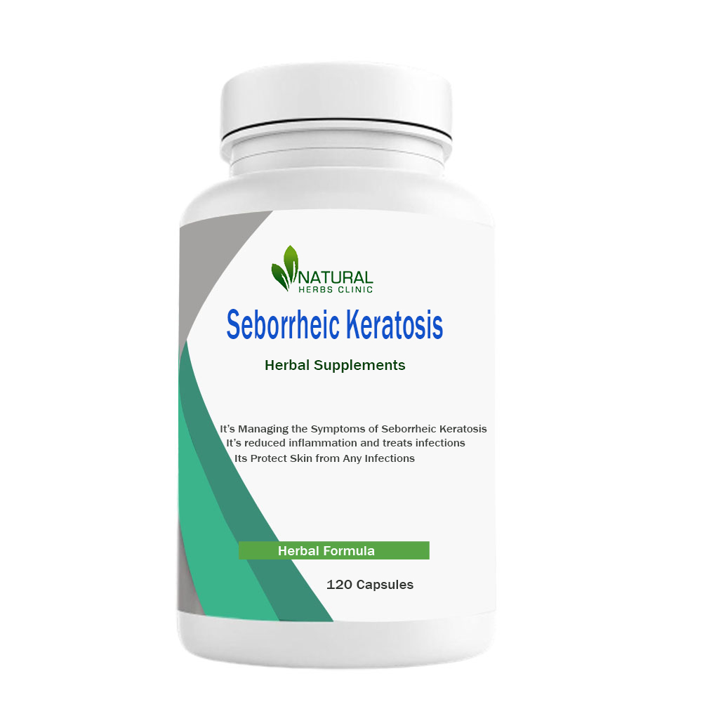 Herbal Supplements for Seborrheic Keratosis