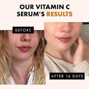 Vitamin C Face Serum1